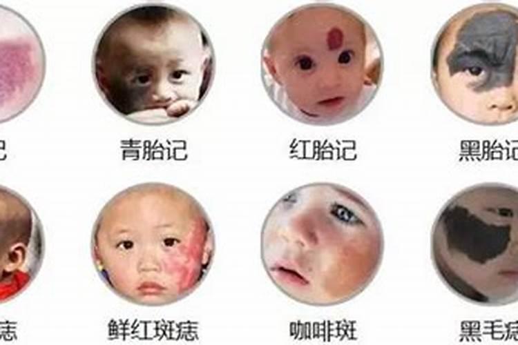 童子身上会有胎记之类的嘛