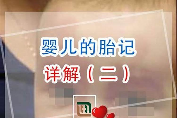 真童子的胎记长在什么位置