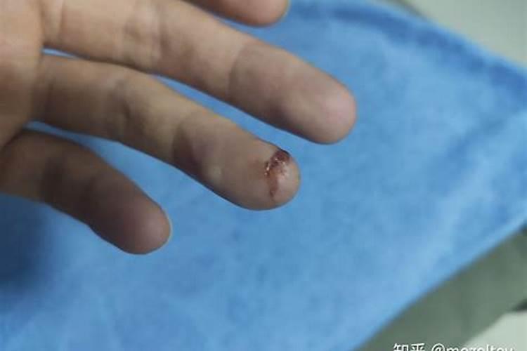 梦到手被人用玻璃划了一个大伤口没出血怎么回事