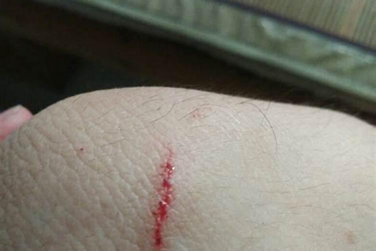 女人梦见猫咬手是吉兆