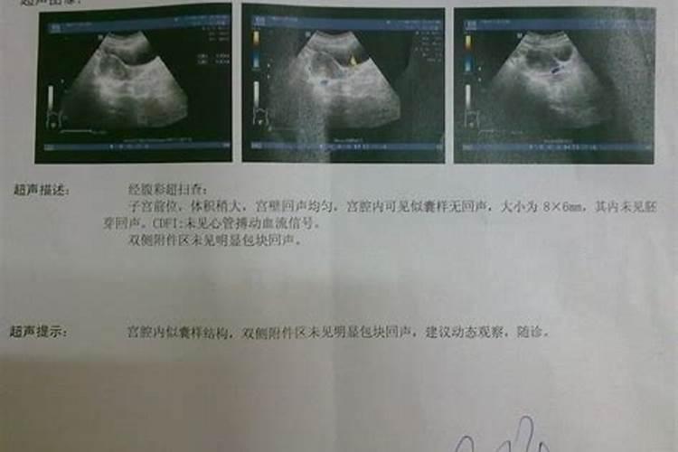 堕胎会影响运势么
