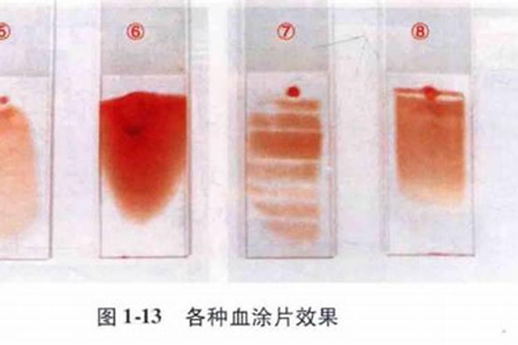 梦见血液和皮肤有问题