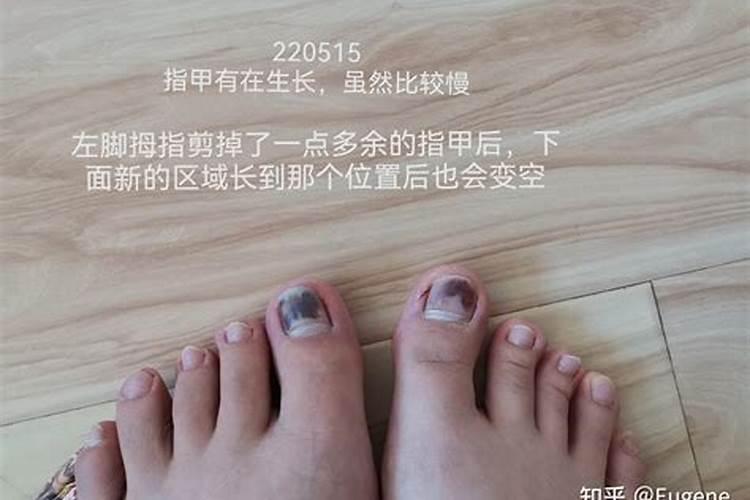 梦见他人脚受伤的预兆