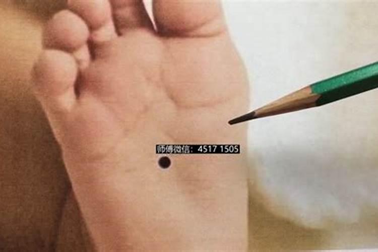 真童子的胎记长在什么位置
