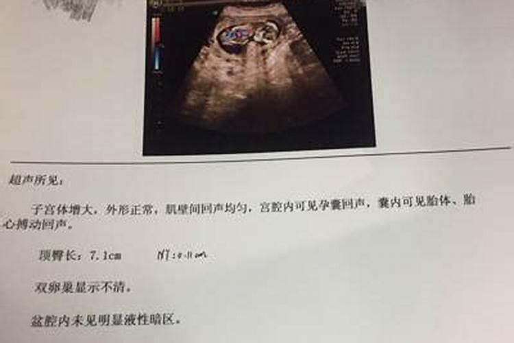 打胎后怎么给孩子超度