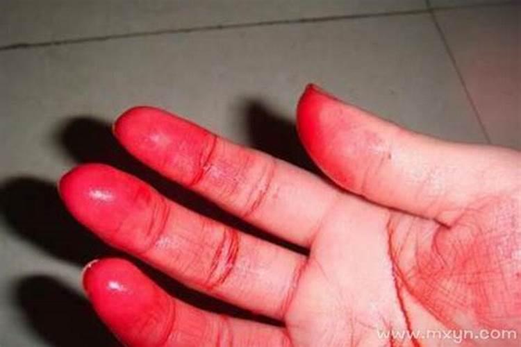 已婚女人梦见自己手流血是吉还是凶？
