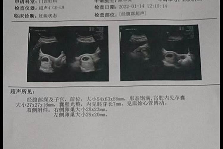 婴灵,不知道大家相信吗