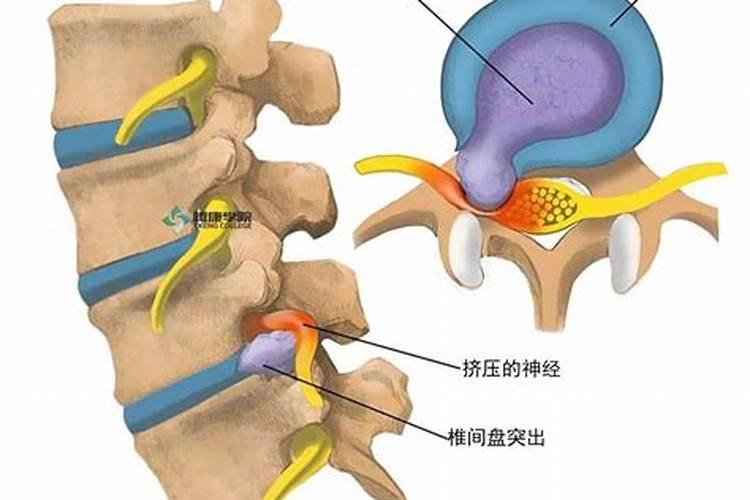 破太岁是什么意思