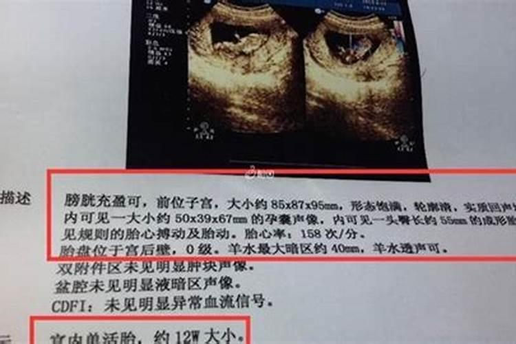 怎么查出来自己怀孕多少天了
