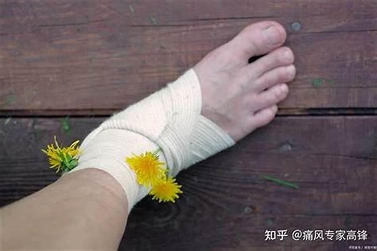 脚受伤风水看哪里怎么化解？