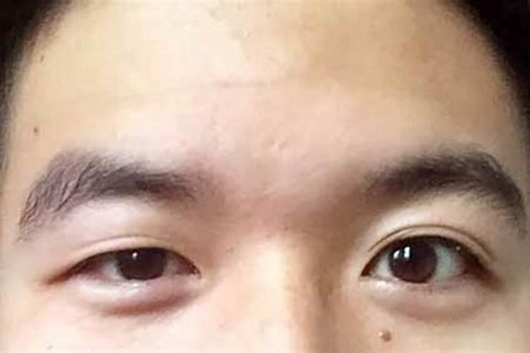 一个眼睛大一个眼睛小命运如何？