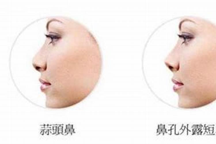 鼻梁上有横纹预示什么？