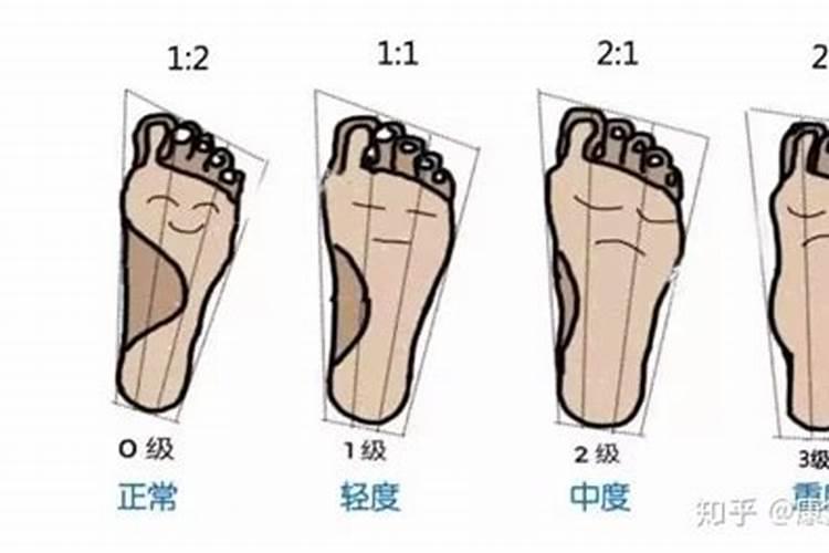 平脚板的人命运怎么样？