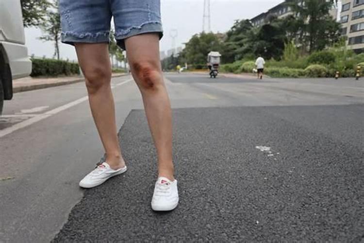 梦见一个男人骑车带一个女人摔男人脸部摔伤