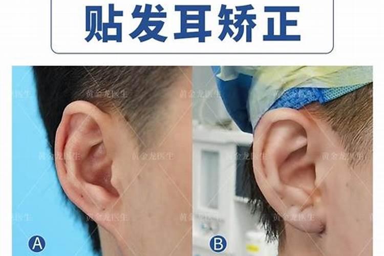 耳垂会随着命运变大吗？